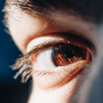 Visão com miopia: cirurgia com lente intraocular é para todo paciente?